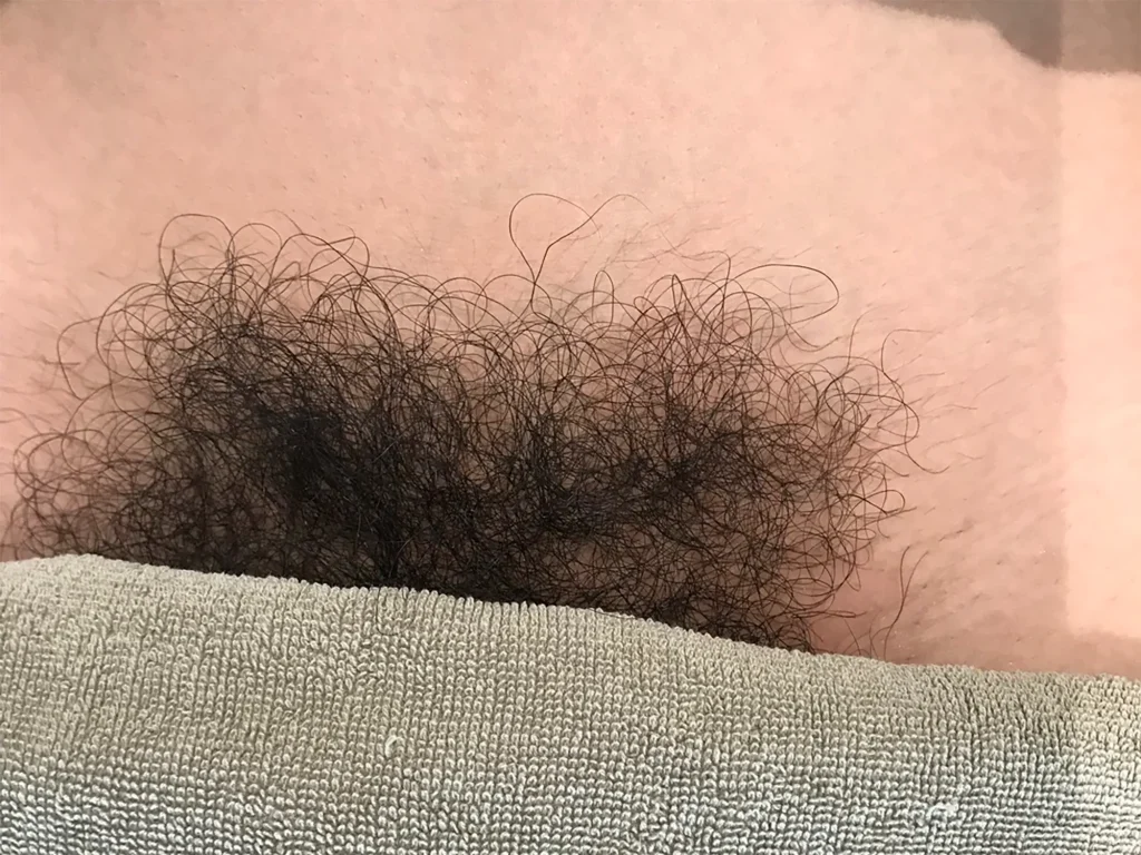 ビフォーアフター写真